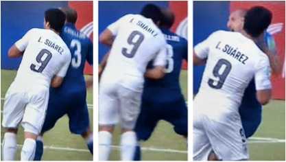 suarezbite