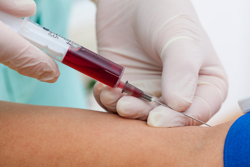 blood-sample-dui