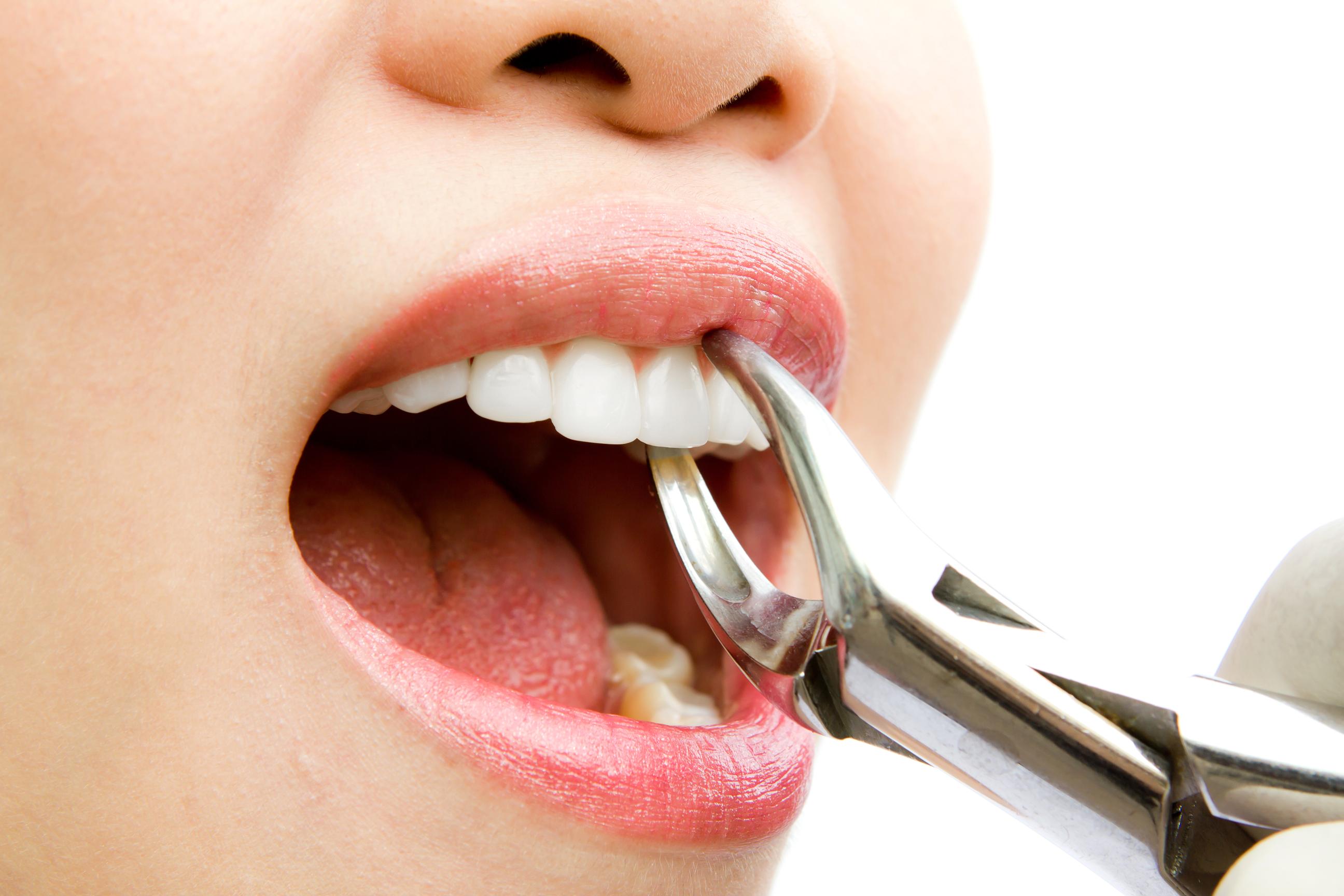 https://centerpointdentalgroup.com/services/tooth-extractions-san-diego/